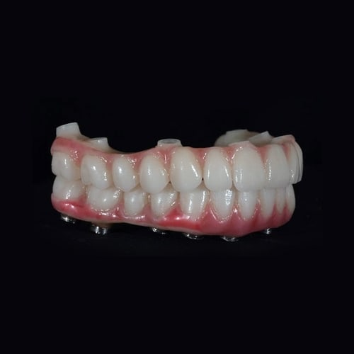 All on X vs All-on-4