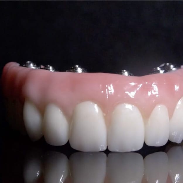 All-On-X Sample Model