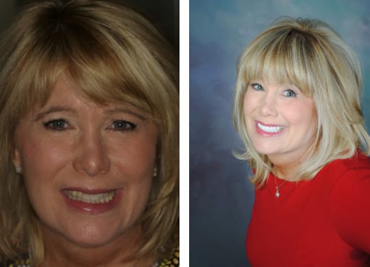 Teeth Making You Old Or Young?  Smiling confident patient at ADS